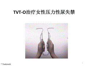 TVTO治疗女性压力性尿失禁.ppt