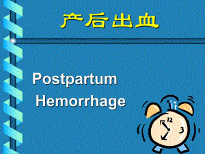 产后出血.ppt