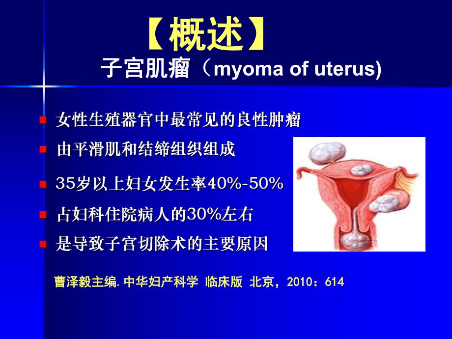 子宫肌瘤诊治.ppt_第2页