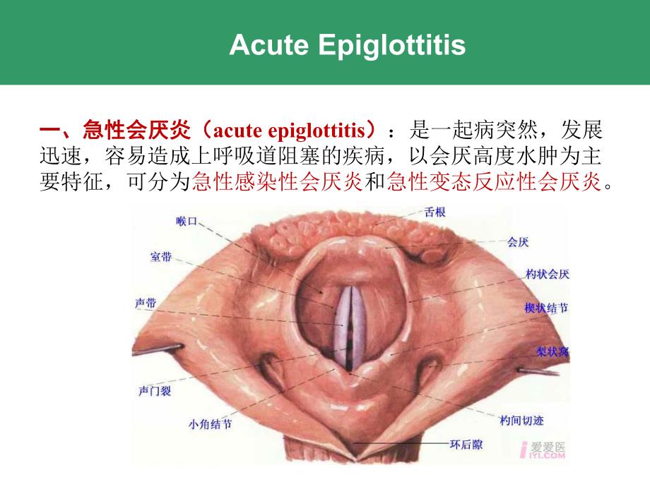 喉的急慢性炎症性疾病..ppt_第3页