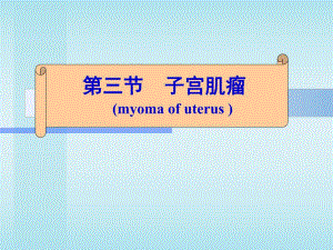 子宫肌瘤概述.ppt.ppt