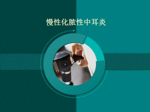 胆脂瘤型中耳炎.ppt