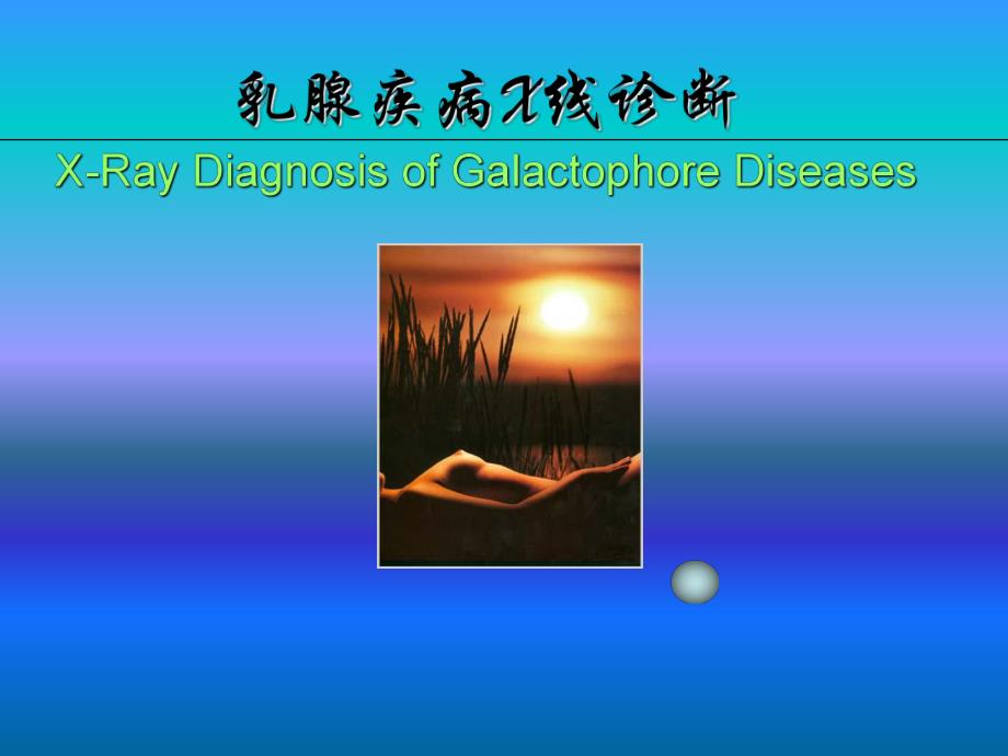 乳腺疾病X线诊断.ppt_第1页