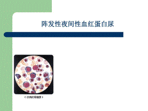 阵发性夜间性血红蛋白尿.ppt