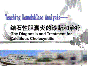 结石性胆囊炎的诊断和治疗.ppt