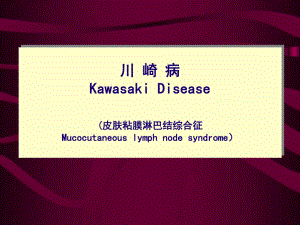 医院川崎病.ppt
