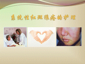 系统性红斑狼疮的护理.ppt
