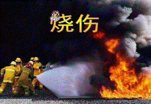 外科说课烧伤.ppt