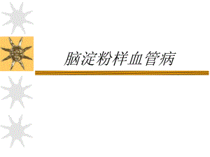 脑淀粉样血管病介绍PPT.ppt