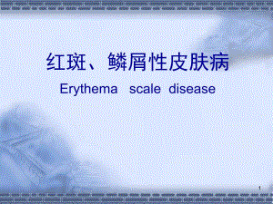 红斑、鳞屑性皮肤病[宝典].ppt