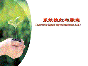 系统性红斑狼疮护理培训.ppt