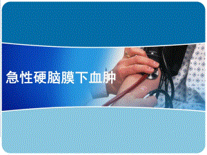 硬膜下血肿..ppt