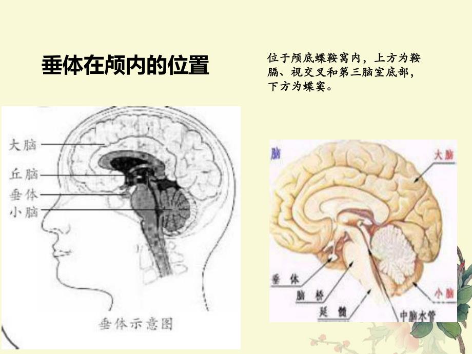 垂体瘤ppt.ppt_第2页