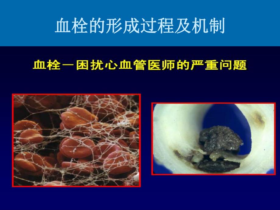 基因多态性与氯吡格雷的个体化应用.ppt.ppt_第2页