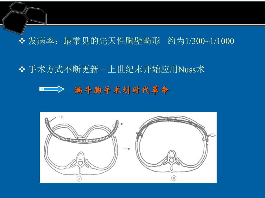 医院手术常见并发症处理及预防1.ppt_第3页