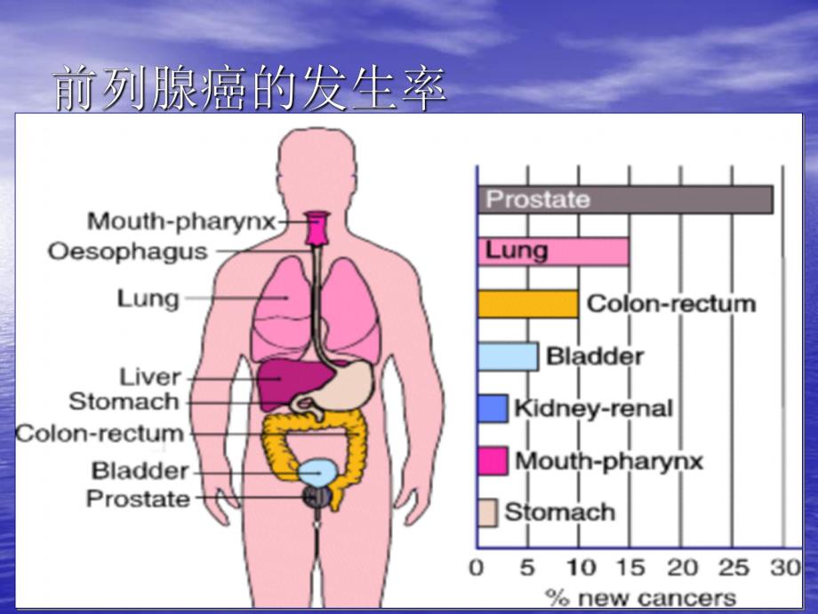 前列腺癌诊治进展.ppt_第2页