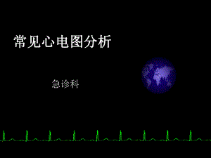 常见心电图分析.ppt