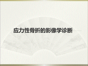 应力性骨折的影像学诊断.ppt