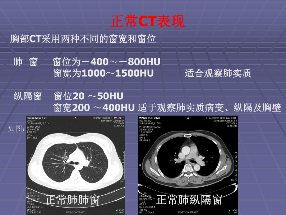 正常胸肺部CT影像学.ppt_第2页