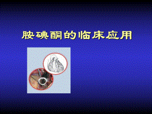 胺碘酮的临床应用.ppt