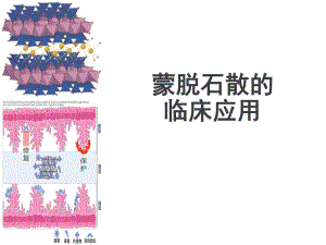 蒙脱石散的临床应用.ppt