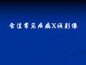 食道常见疾病影像学.ppt