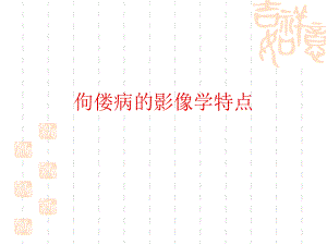 佝偻病的影像学特点.ppt