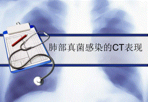 肺部真菌感染的影像学表现.ppt