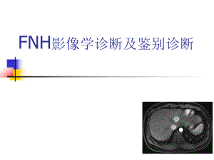 FNH影像学诊断及鉴别诊断.ppt