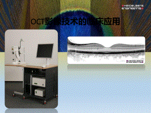 OCT影像技术的临床应用.ppt