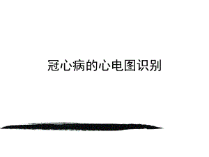 冠心病的心电图识别.ppt