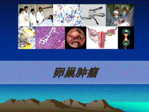 卵巢肿瘤医学课件PPT课件.ppt