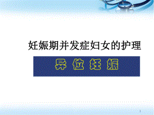 宫外孕的护理医学PPT课件.ppt