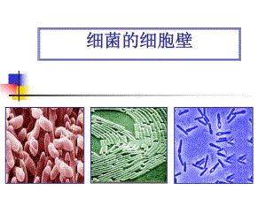 微生物的细胞壁结构.ppt