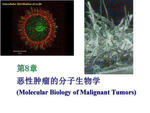 恶性肿瘤的分子生物学.ppt