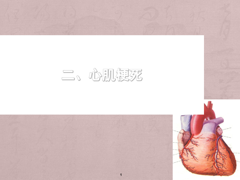 心肌梗死的护理PPT精品医学课件.ppt_第1页