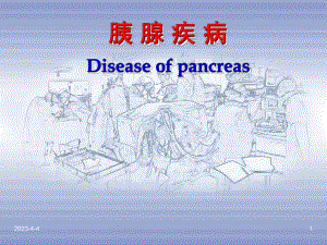 胰腺疾病PPT医学课件.ppt