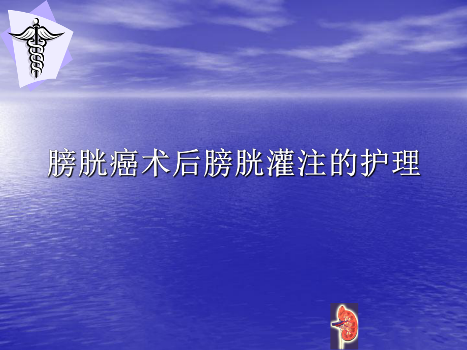 膀胱癌术后膀胱灌注的护理医学PPT课件.ppt_第1页