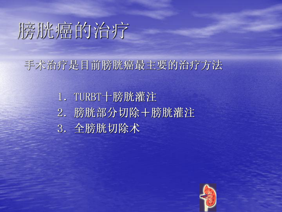 膀胱癌术后膀胱灌注的护理医学PPT课件.ppt_第3页