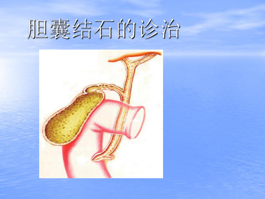 胆结石医学PPT课件.ppt_第1页