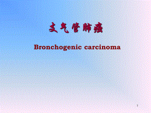 肺部肿瘤精品医学课件.ppt