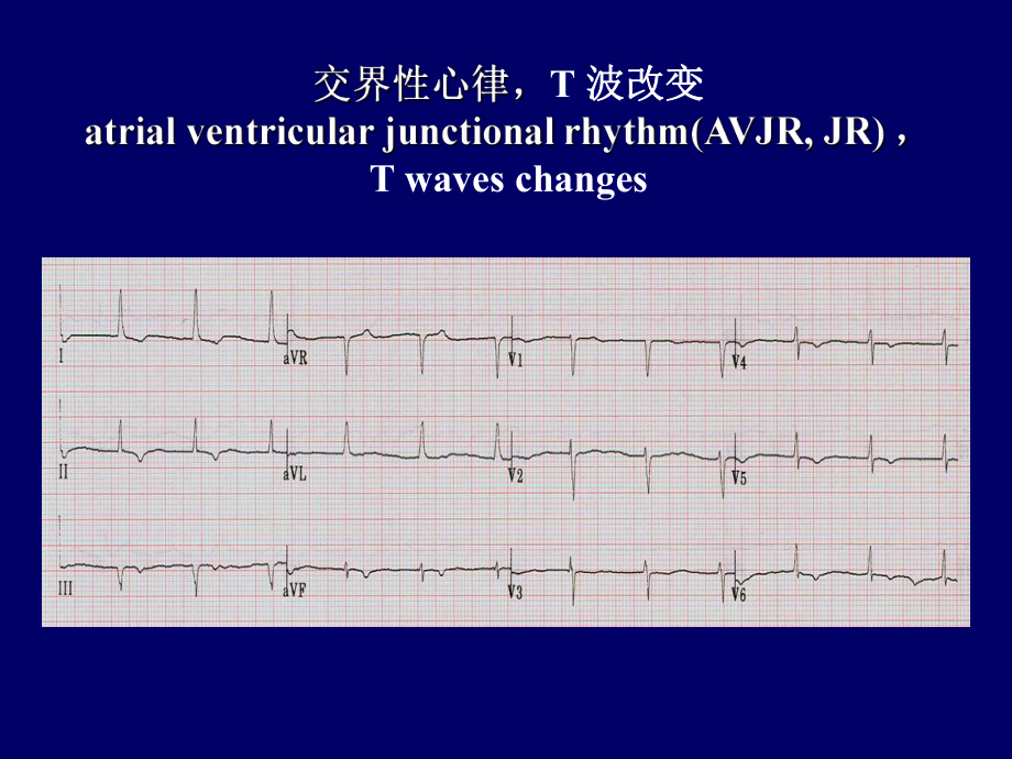 心电图练习题.ppt_第3页