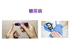 13糖尿病.pptx