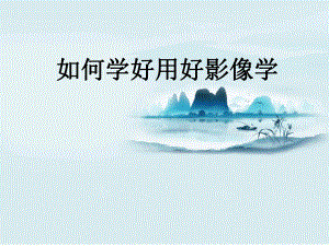 一氧化碳中毒及迟发性脑病影像学表现.pptx