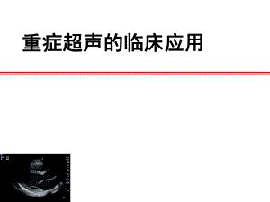 重症超声的临床应用.pptx