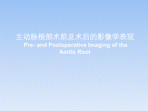 主动脉根部术前及术后的影像学表现.pptx