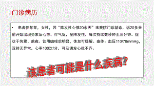 室性早搏医学PPT课件.pptx