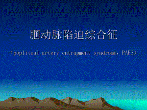 腘动脉陷迫综合征影像学诊断.pptx