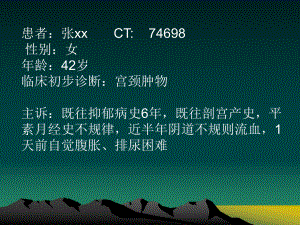 子宫肌瘤影像学诊断.pptx