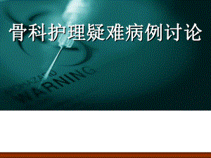 护理疑难病例讨论.pptx